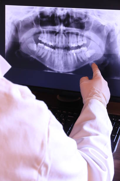 Best Emergency Root Canal Treatment in Fairchild Af, WA