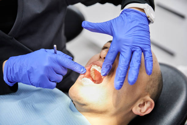 Best Emergency Broken Tooth Repair in Fairchild Af, WA