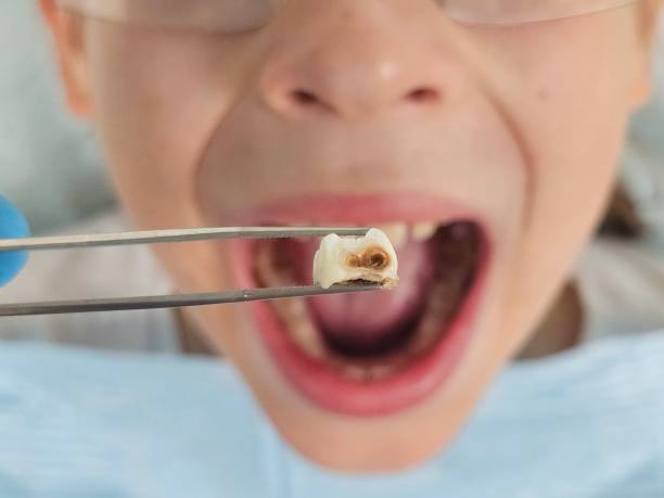 Best Emergency Dental Surgery in Fairchild Af, WA
