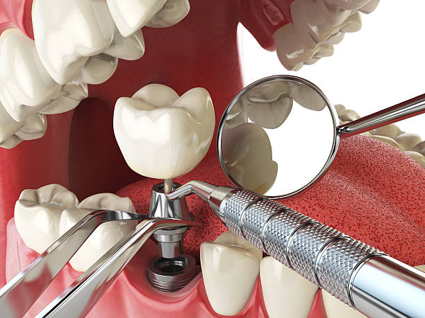 Best 24-Hour Emergency Dentist in Fairchild Af, WA